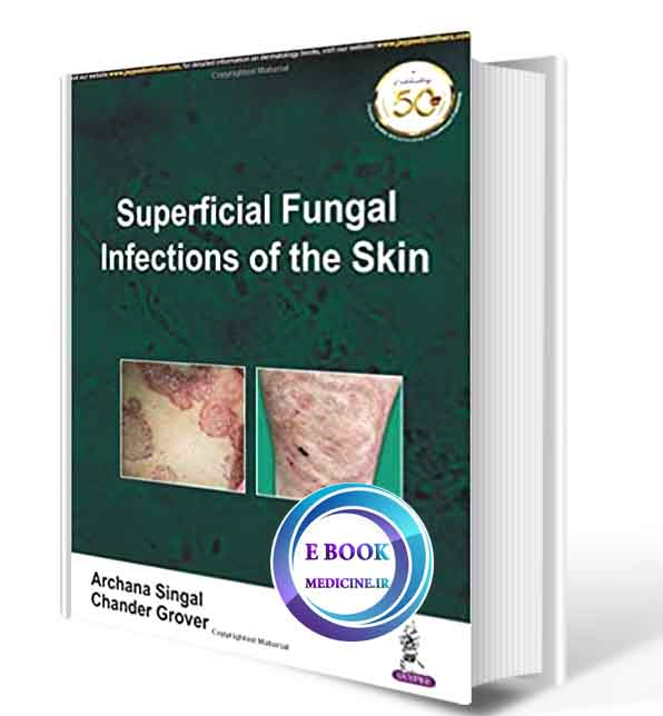 دانلود کتاب Superficial Fungal Infections Of The Skin 2019 (Original PDF)